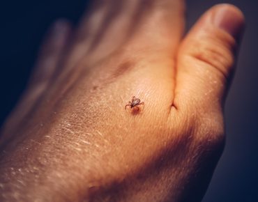 tick crawling on human hand